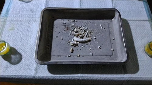 残肢火化，骨灰留存！(图2)