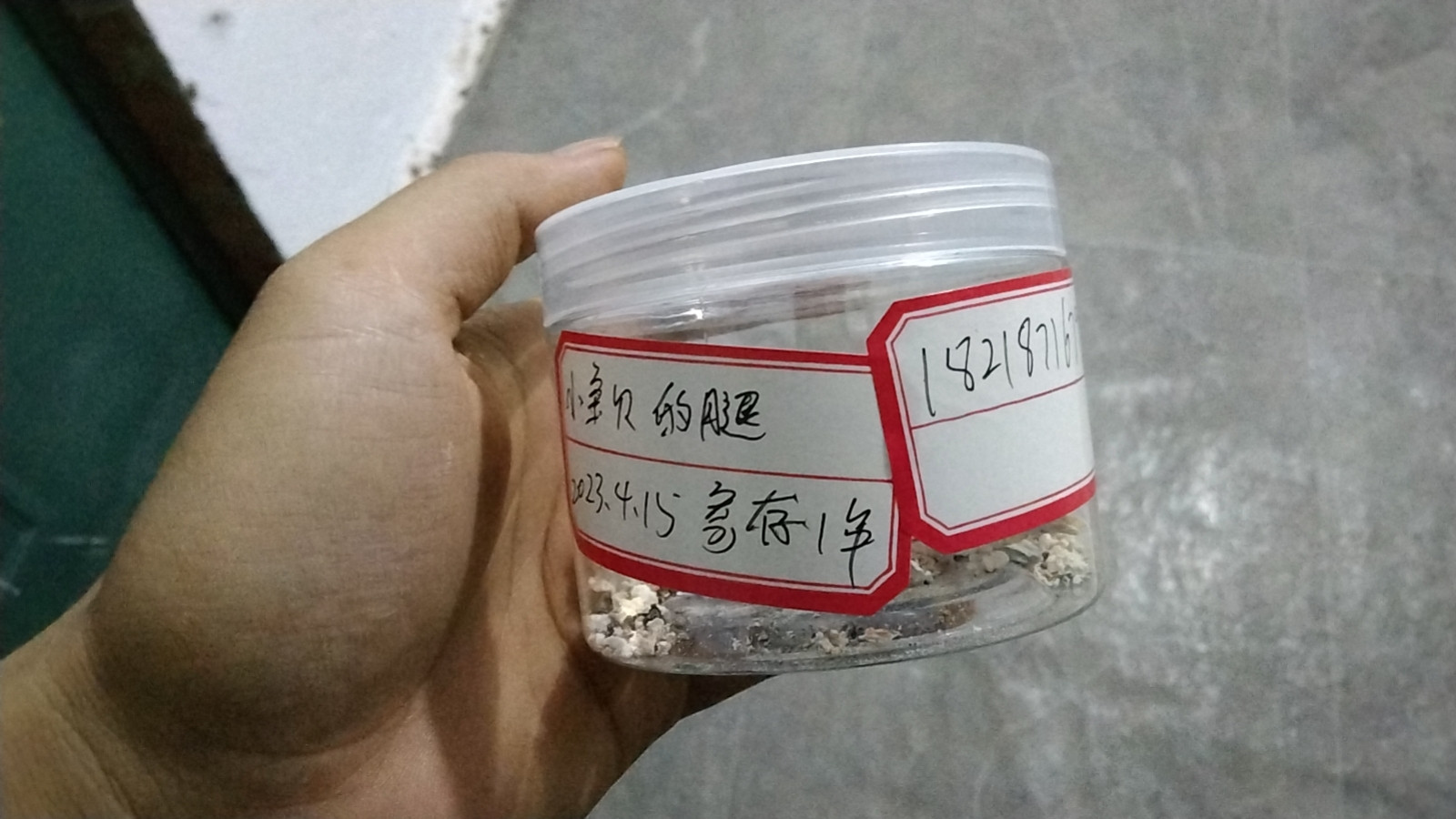 残肢火化，骨灰留存！(图3)